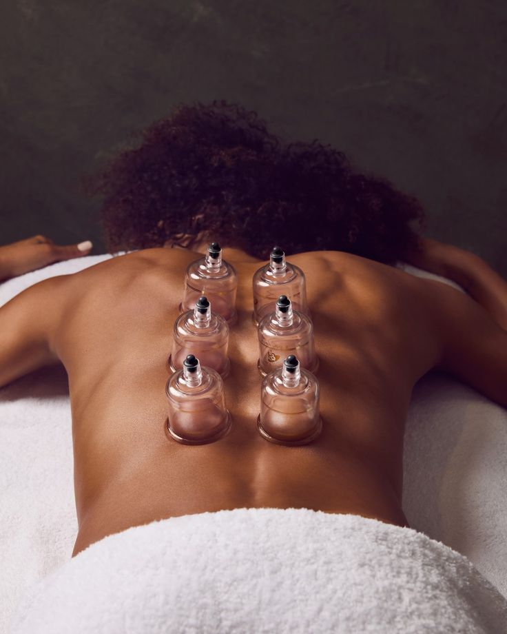 Cupping Therapy